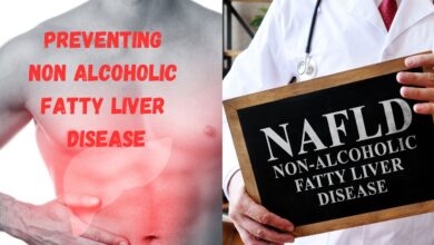 A Potential Solution for Preventing Nonalcoholic Fatty Liver Disease and Enhancing Survival