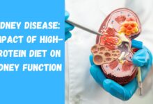 Kidney Disease: Impact of High-Protein Diet on Kidney Function, Risks, and Prevention