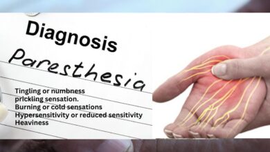 Paresthesia