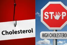 Cholesterol