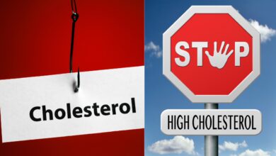 Cholesterol